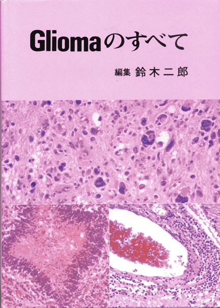 Gliomaのすべて 